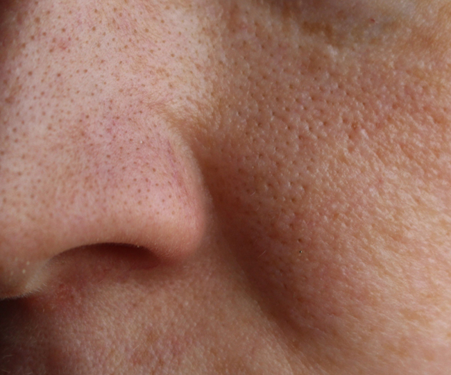 pore